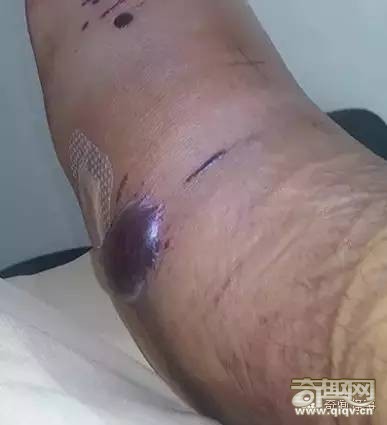 真的好恐怖！在这里上厕所一定要先冲水...慎入！！