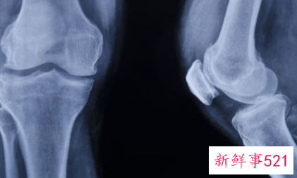 半月板损伤民间老偏方