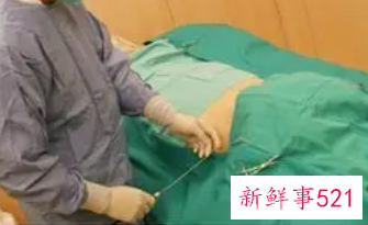 丰胸针安全吗