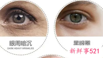做眼部护理的好处和作用