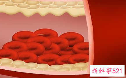 不同血型的人有什么特点
