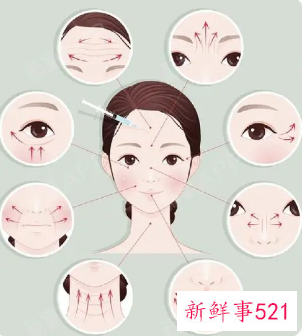 怎样快速去除眼下皱纹