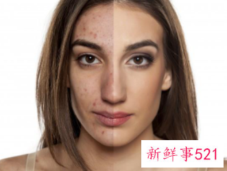 怎样正确使用精华素