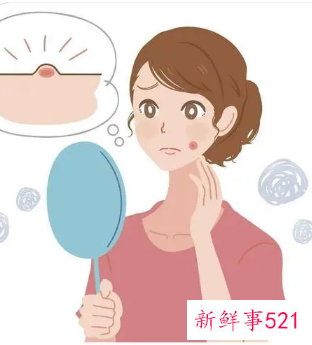 怎样才能祛除痘痘和痘印