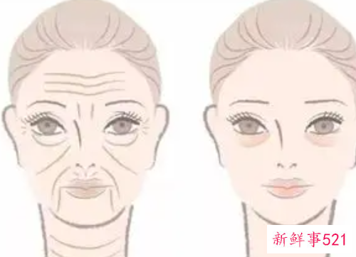用什么可以去皱纹效果好啊