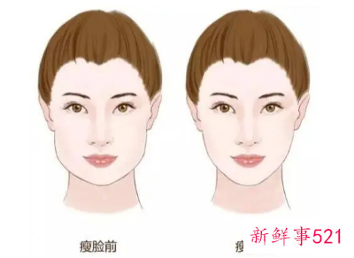 怎么吃出锥子脸