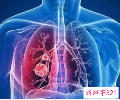 哮喘晚期一般能活多久