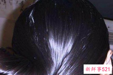 用醋洗头发可以去油吗