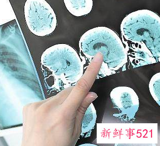 ct对身体会有哪些伤害