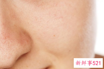 皮肤干燥起皮屑是什么原因
