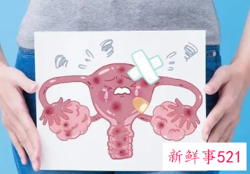 有妇科病怎么自己处理