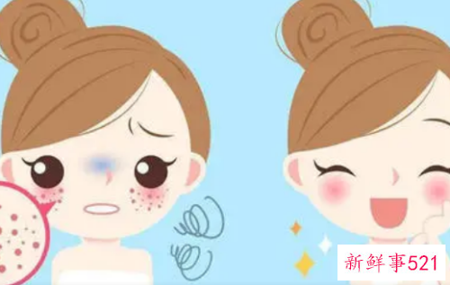 脸部皮肤粗糙怎么样变得细腻