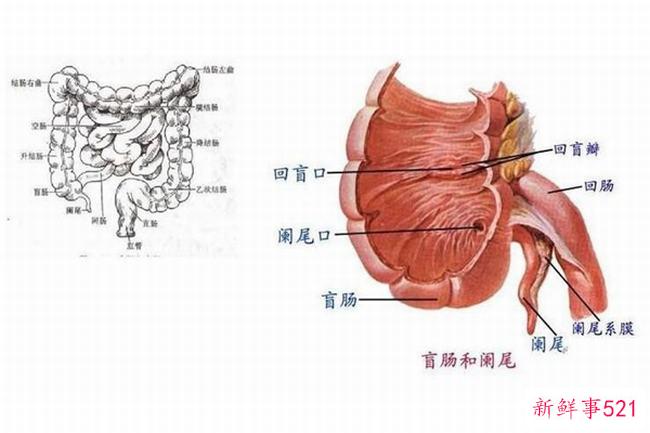 盲肠和阑尾是一回事吗？阑尾是盲肠的末端(盲肠不能切)