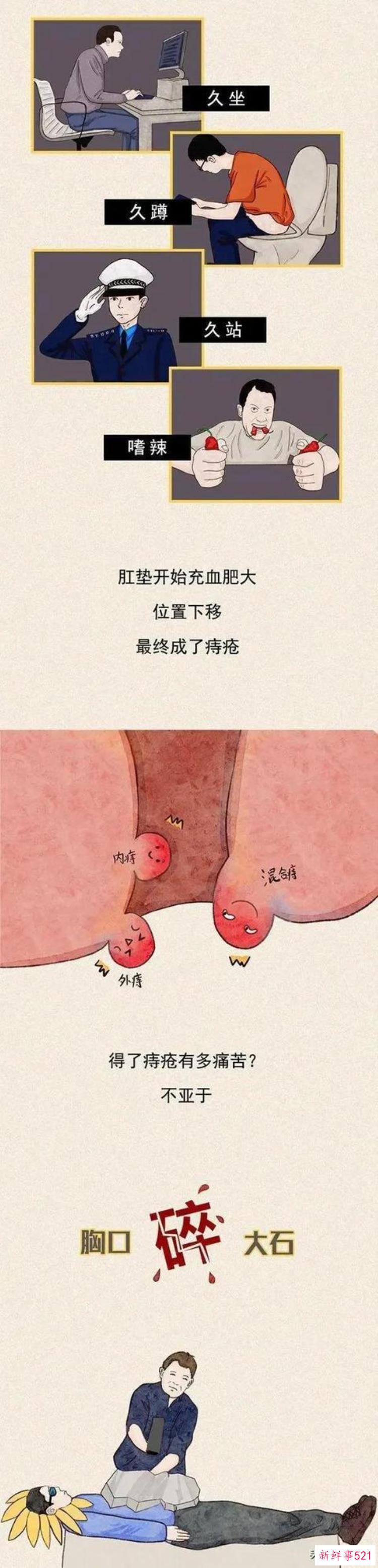 提肛运动的好处，怎么练收肛效果最好