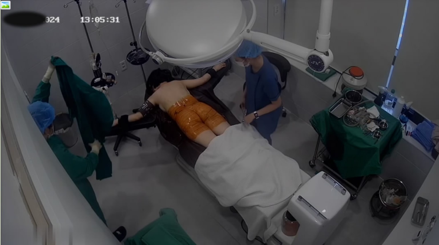 新流出❤️黑客破解整形医院手术室监控摄像头偷拍美女丰胸美臀手术速度还挺快的