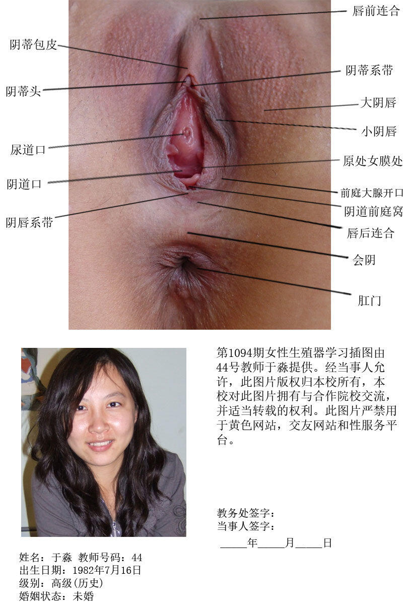 一所私立学校的女性生殖器教学插图