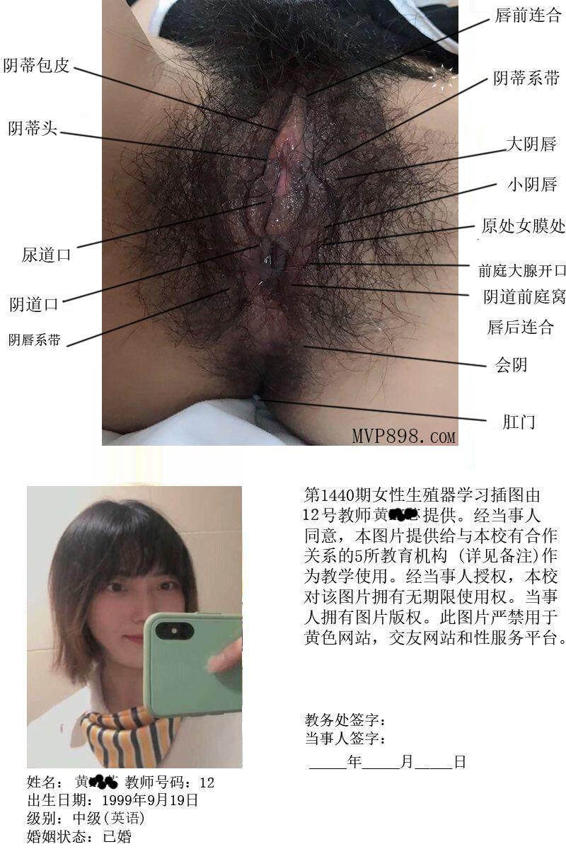 一所私立学校的女性生殖器教学插图