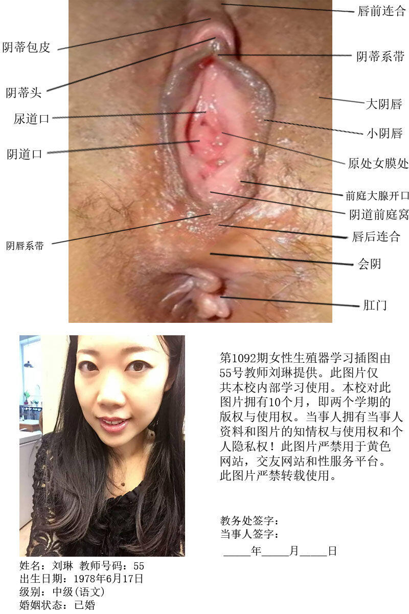 一所私立学校的女性生殖器教学插图
