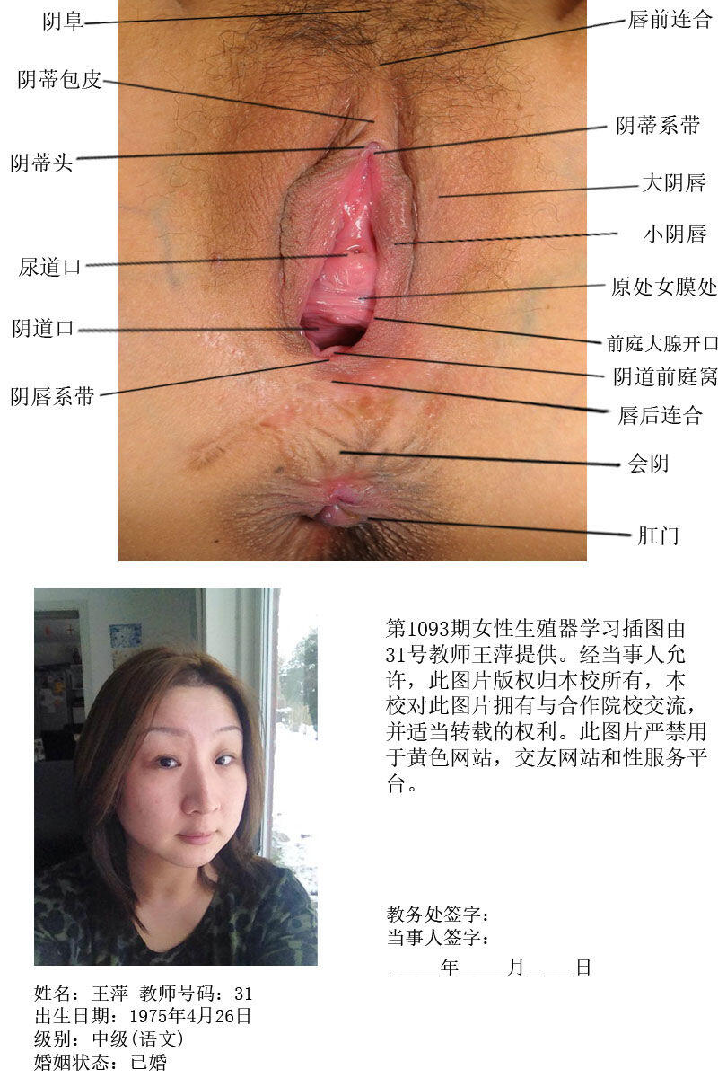 一所私立学校的女性生殖器教学插图