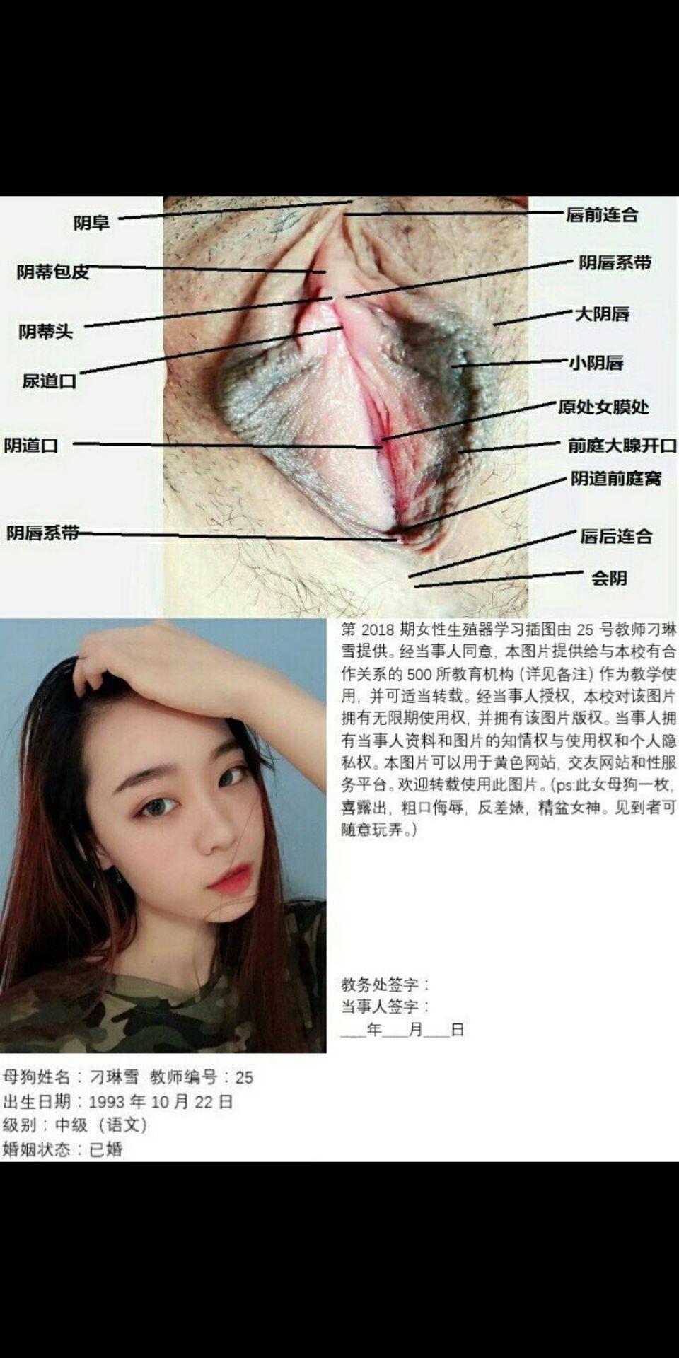 一所私立学校的女性生殖器教学插图