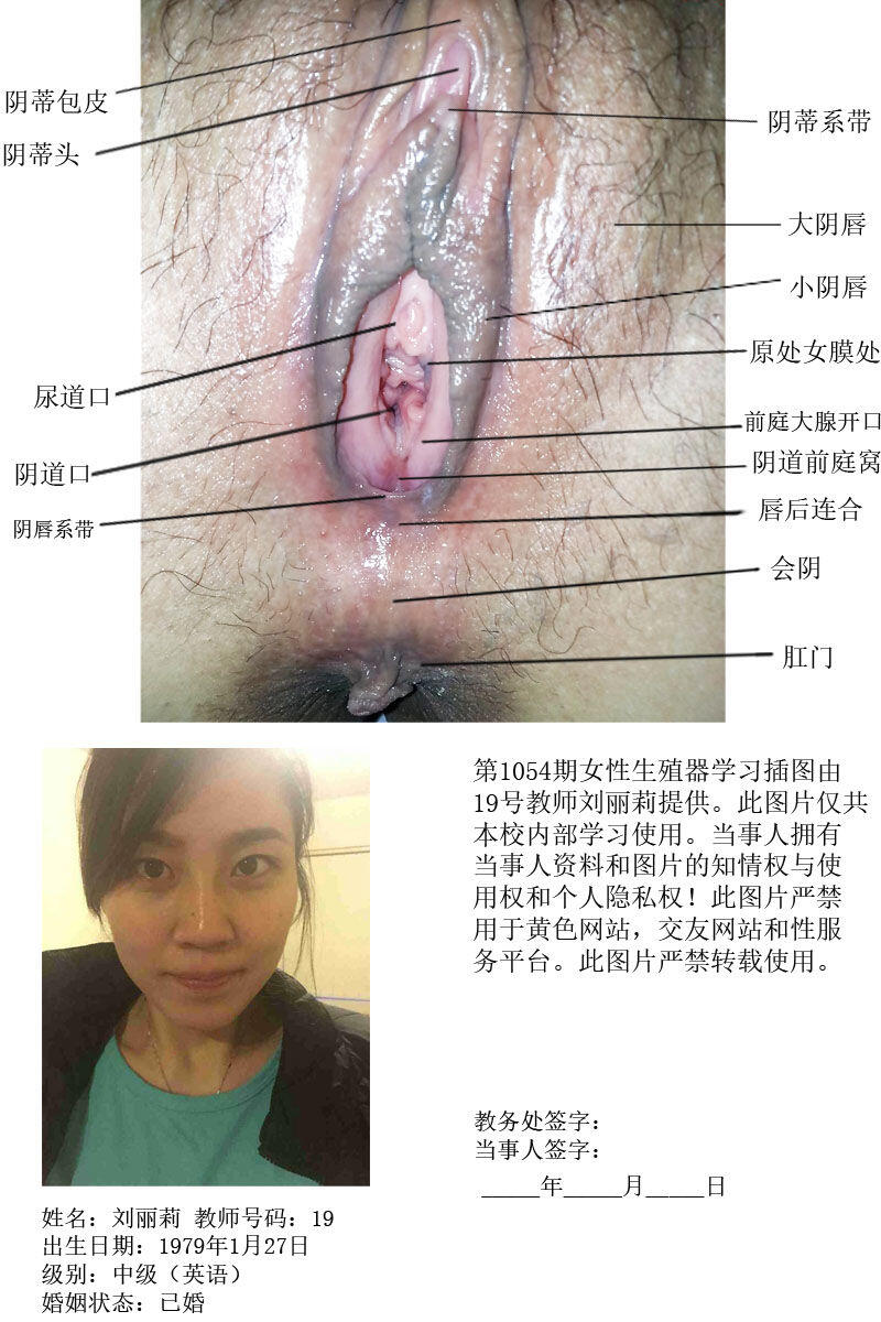 一所私立学校的女性生殖器教学插图