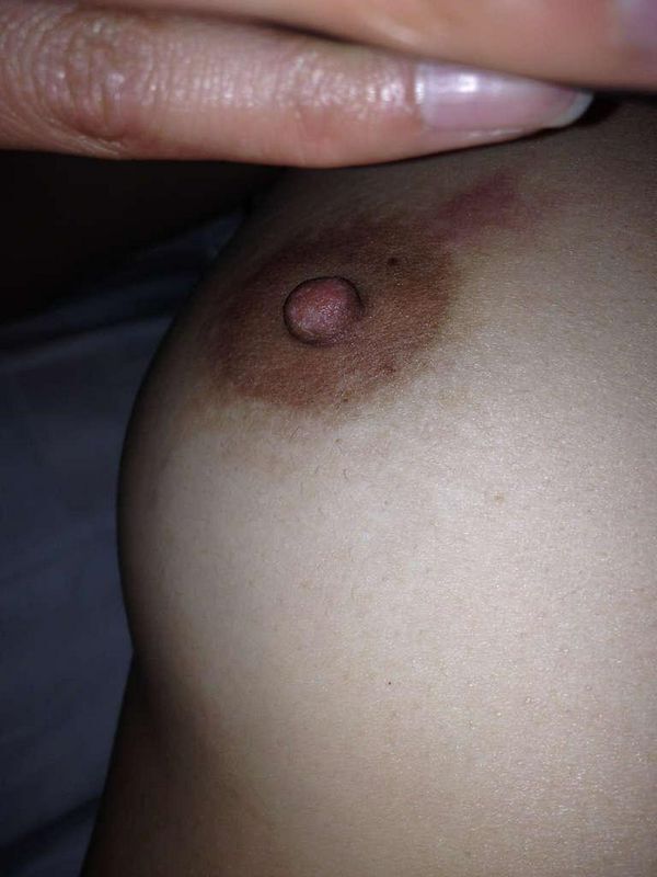 解除隔离来一发