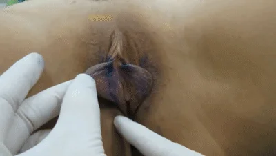 ❤️猎奇❤️整容医院医生讲解如何手术割阴唇，黑木耳变粉嫩馒头逼，这就是医学的力量！