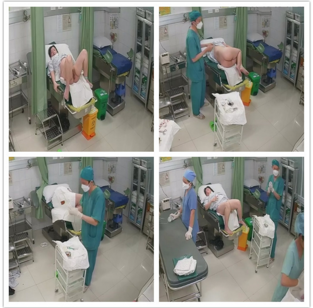 《妇产科监控破解》 偷窥几个少妇做人流和生孩子全过程