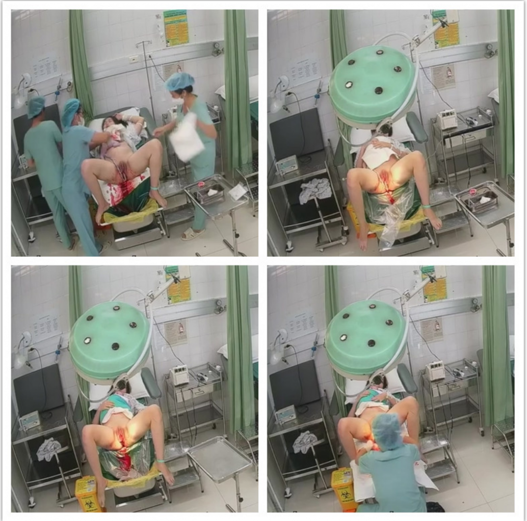 《妇产科监控破解》 偷窥几个少妇做人流和生孩子全过程