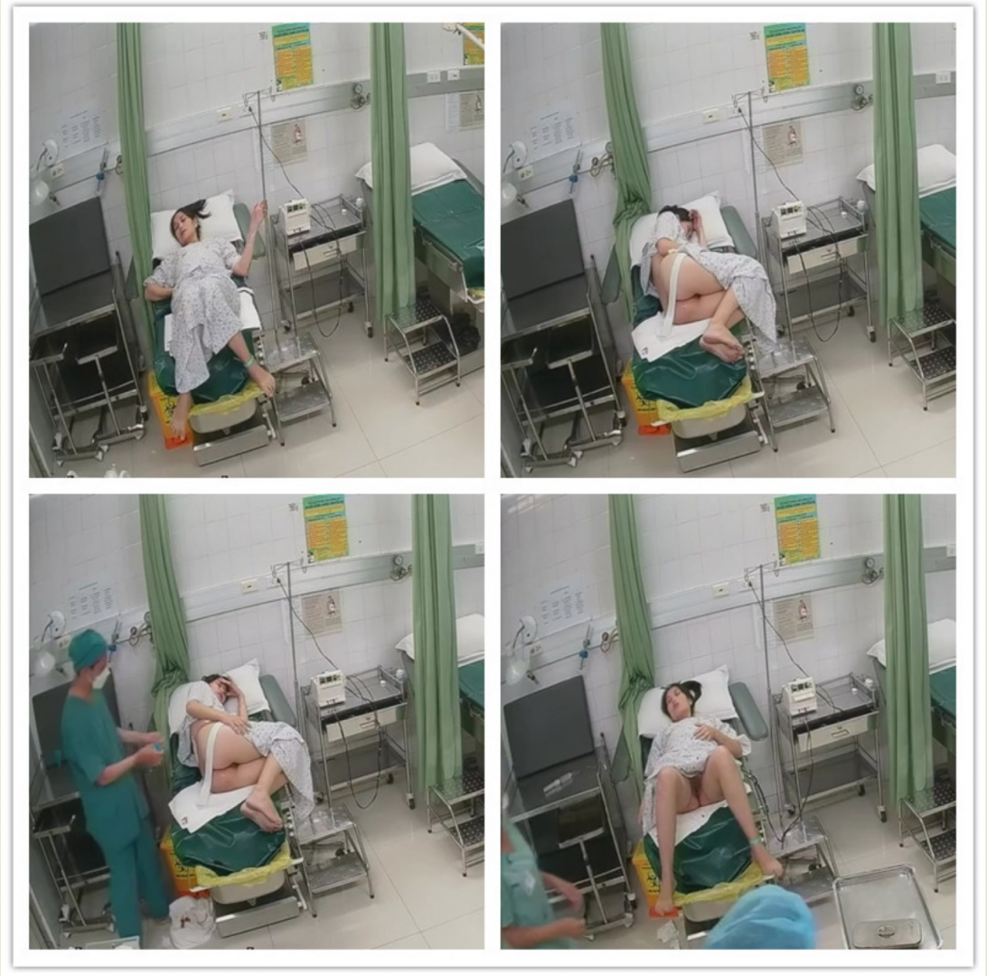 《妇产科监控破解》 偷窥几个少妇做人流和生孩子全过程
